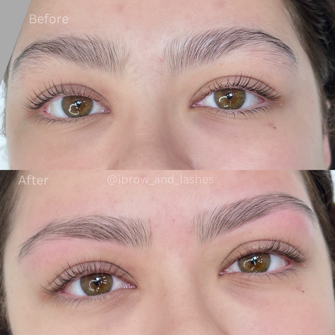 brow before